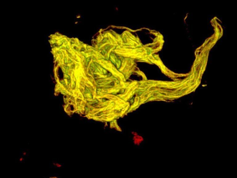 Neurobiólogo mexicano desarrolla técnica que podría curar parkinson, esquizofrenia o epilepsia