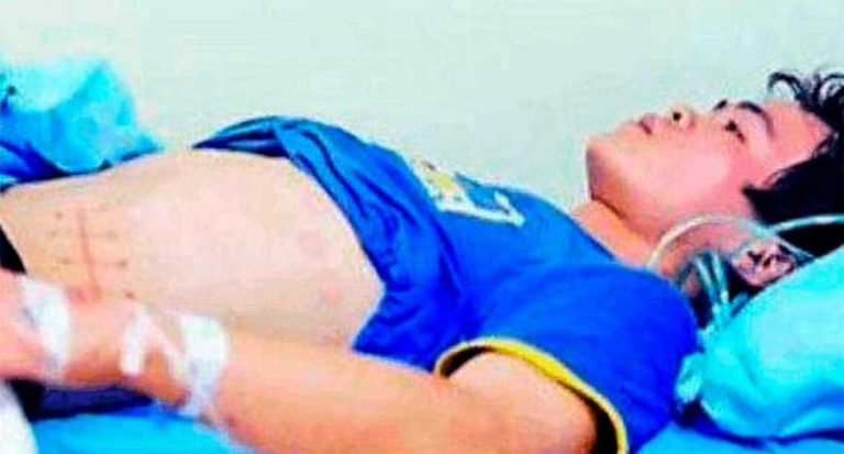 Hombre vende riñón para comprar iPhone y queda discapacitado