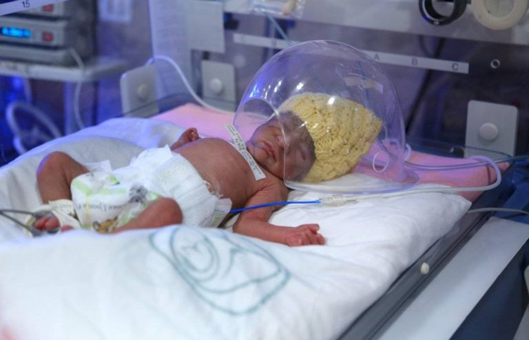 Nacen quintillizos en hospital del IMSS; todos son diferentes