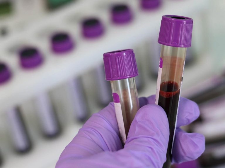 Crean prueba que detecta siete tipos de cáncer