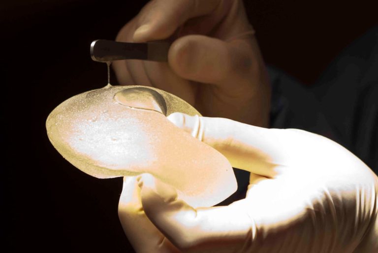 Alertan riesgo de linfomas por implantes mamarios de tejido biocell