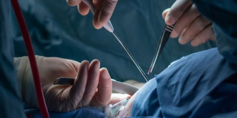 Jornadas de vasectomía sin bisturí en el centro de salud totalmente gratis