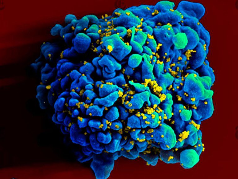 Es posible que una mujer se haya curado del VIH sin tratamiento médico