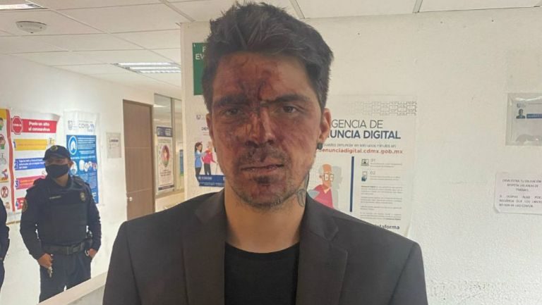 Acusa César D’Alessio a Arturo Montiel por ataque y amenazas