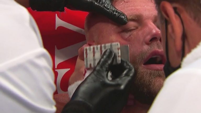 Operan de emergencia a Saunders tras golpe del ‘Canelo’