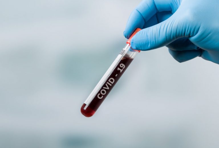 Muere mujer de 65 años por Covid-19 en Culiacán; van 52 en el año