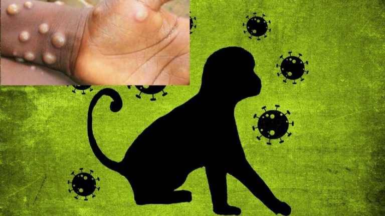 Los 12 estados con casos de viruela del mono en México