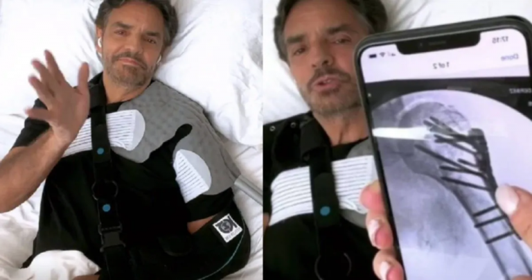 No voy a poder levantar el brazo: Derbez