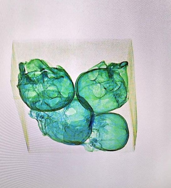 Aseguran 4 cráneos humanos en aeropuerto de Querétaro