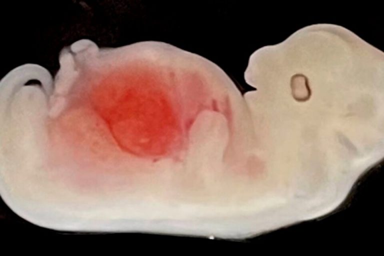 Cultivan órganos humanos… en cerdos