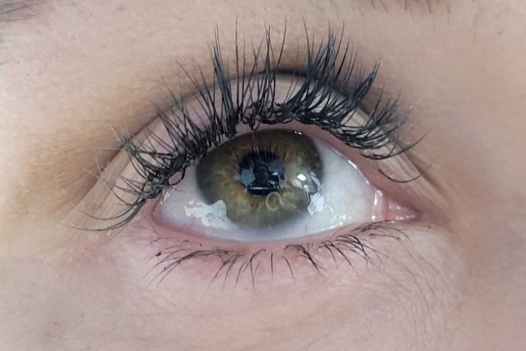 Los ojos secos, enfermedad frecuente durante invierno