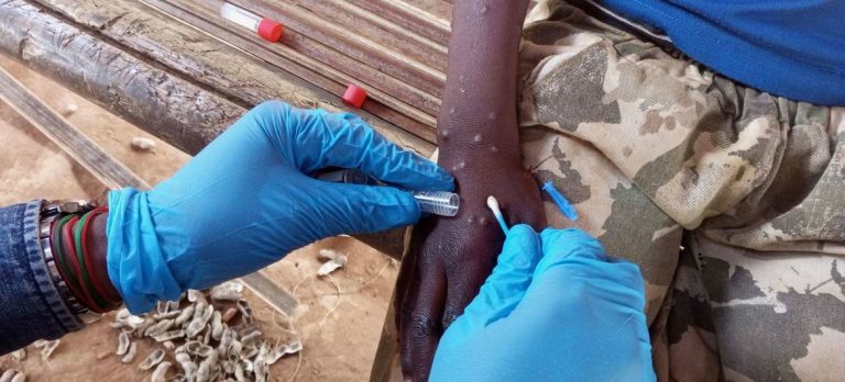Mpox: la emergencia mundial de salud pública