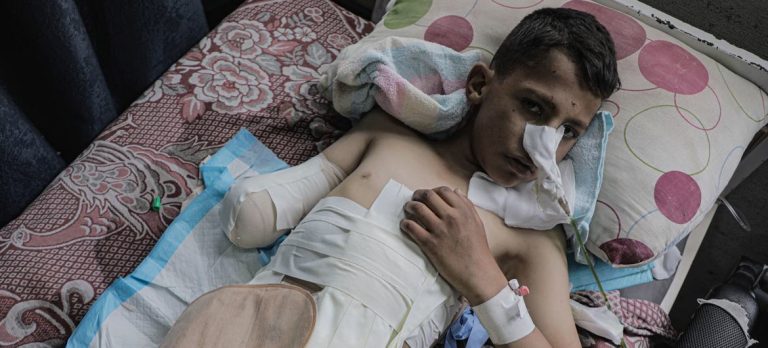 Gaza: más de 10 mil niños han sufrido lesiones de por vida