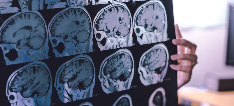 El 45% del riesgo de demencia puede prevenirse o retrasarse